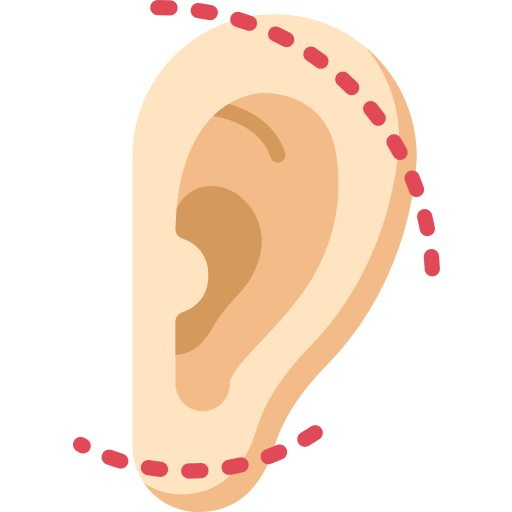 Otoplasty
