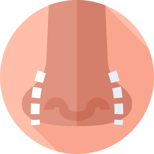 Rhinoplasty